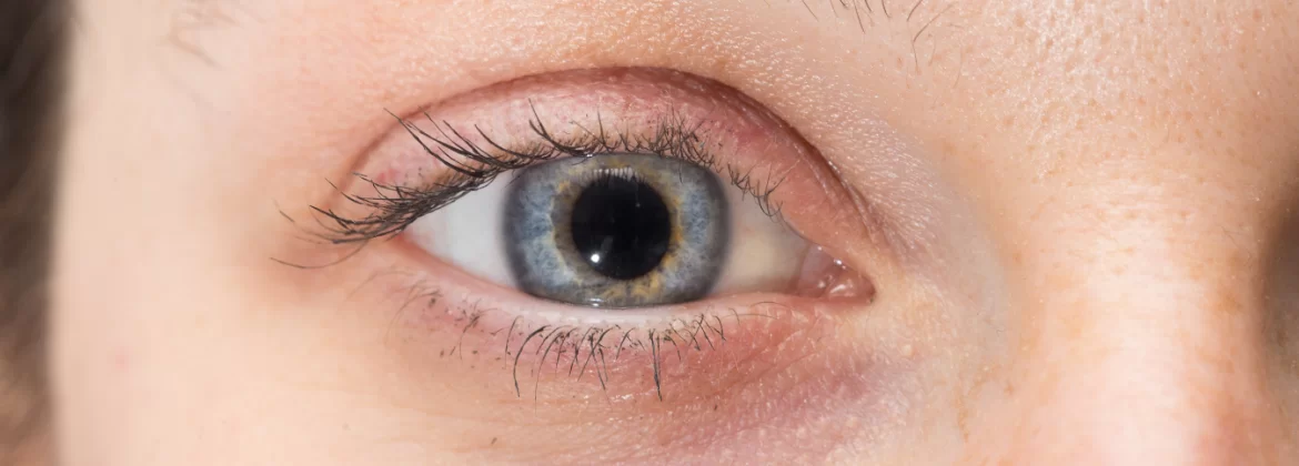 Pupilas dilatadas: ¿ A qué se debe este fenómeno?